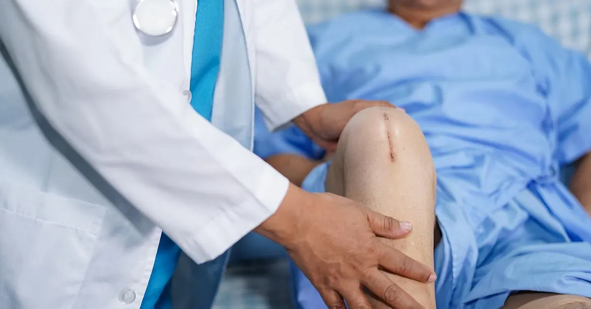 Knee Replacement cost in India and knee surgery types